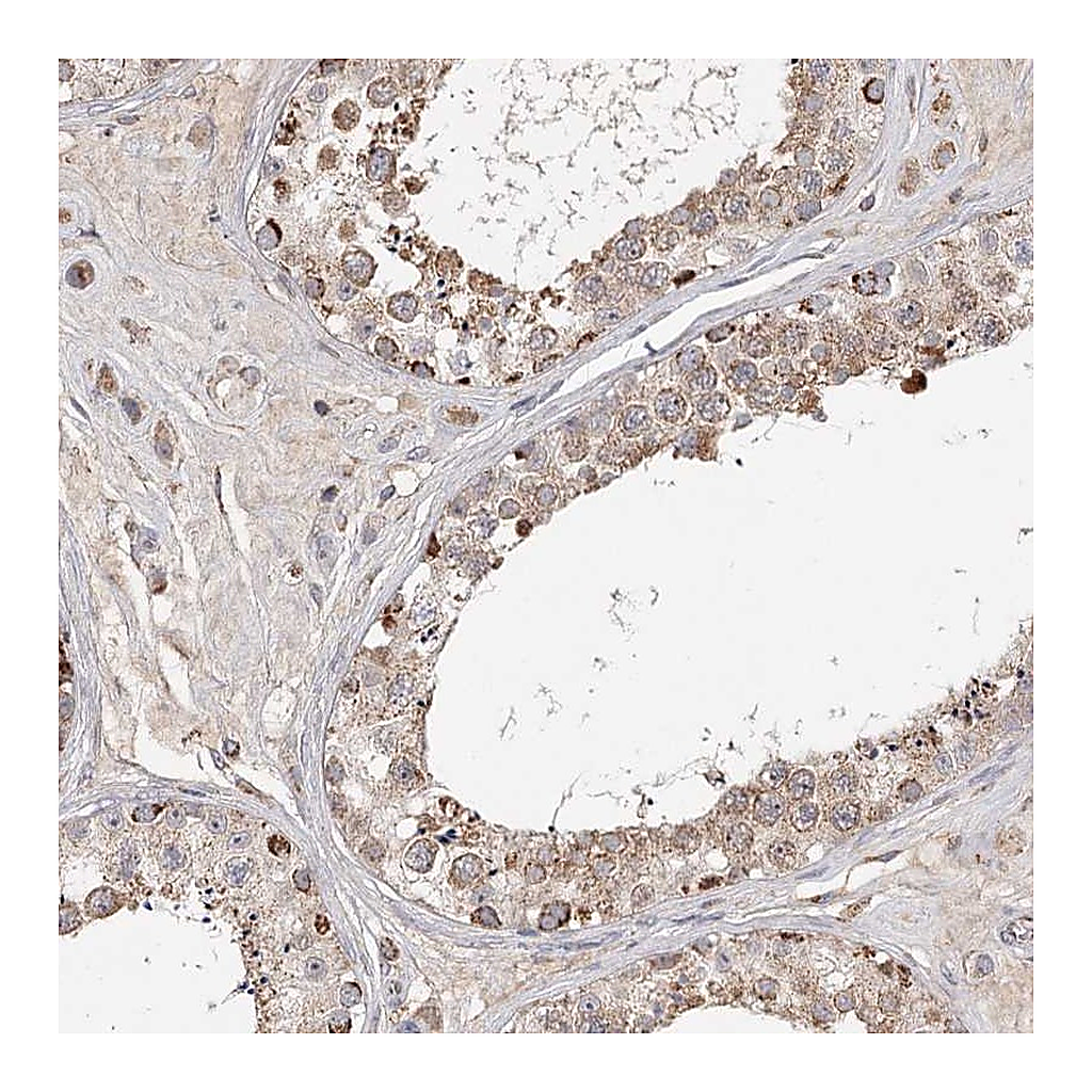 Atlas Antibodies Anti-CDC123 Antibody