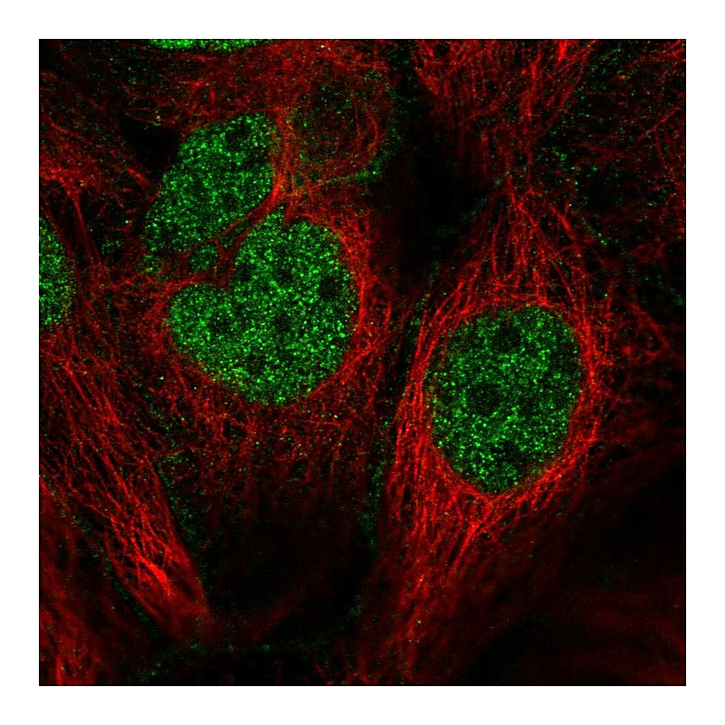 Atlas Antibodies Anti-CDC14B Antibody