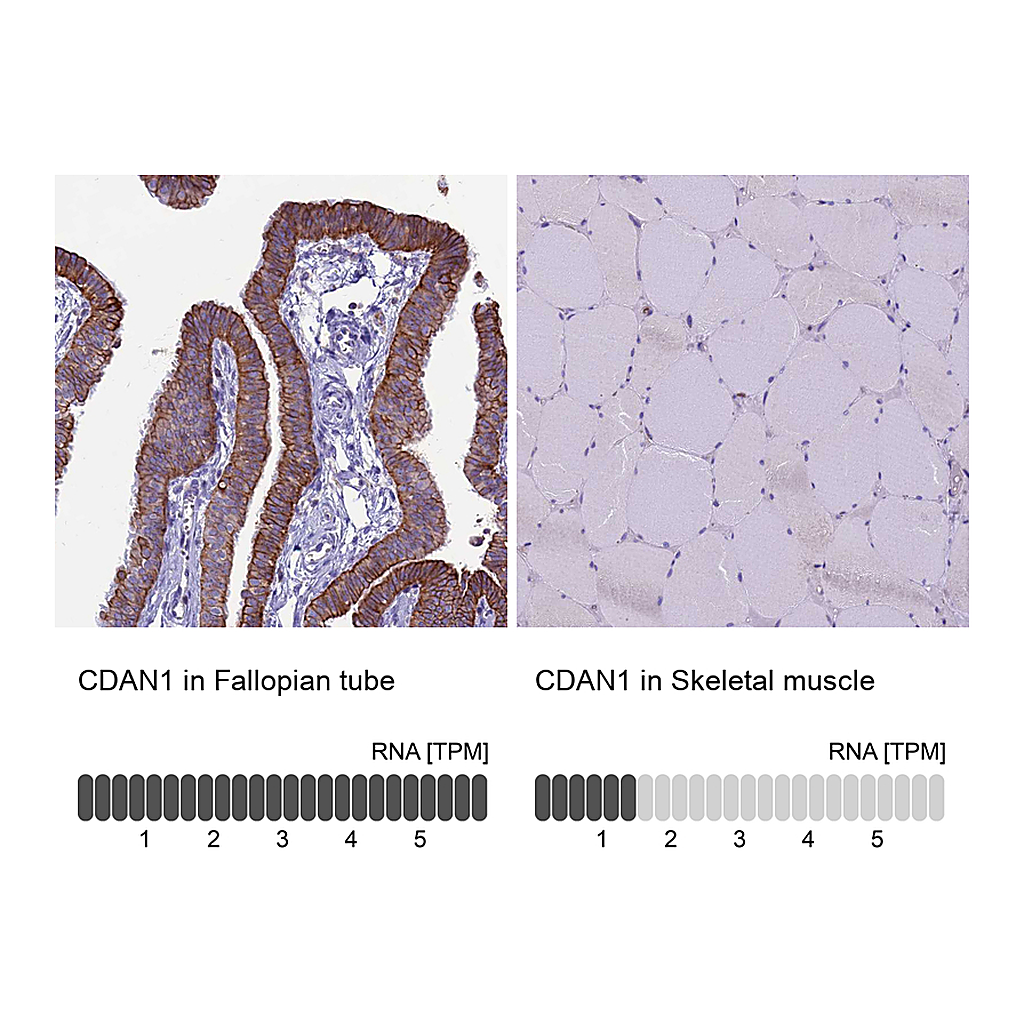 Atlas Antibodies Anti-CDAN1 Antibody