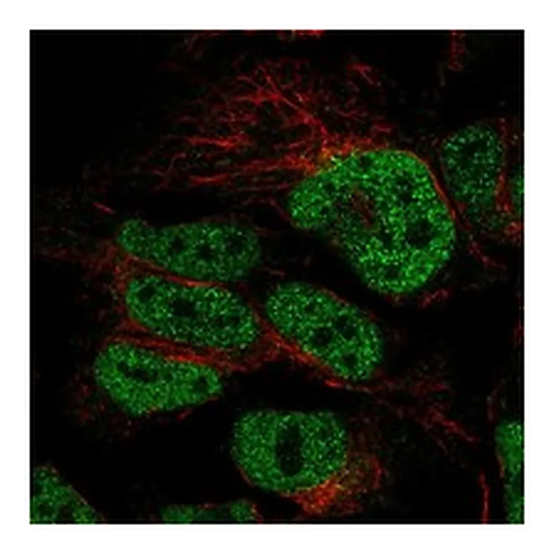 Atlas Antibodies Anti-CDC25A Antibody