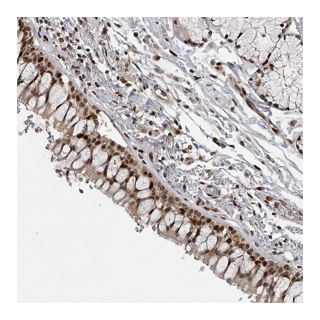 Atlas Antibodies Anti-CDC27 Antibody