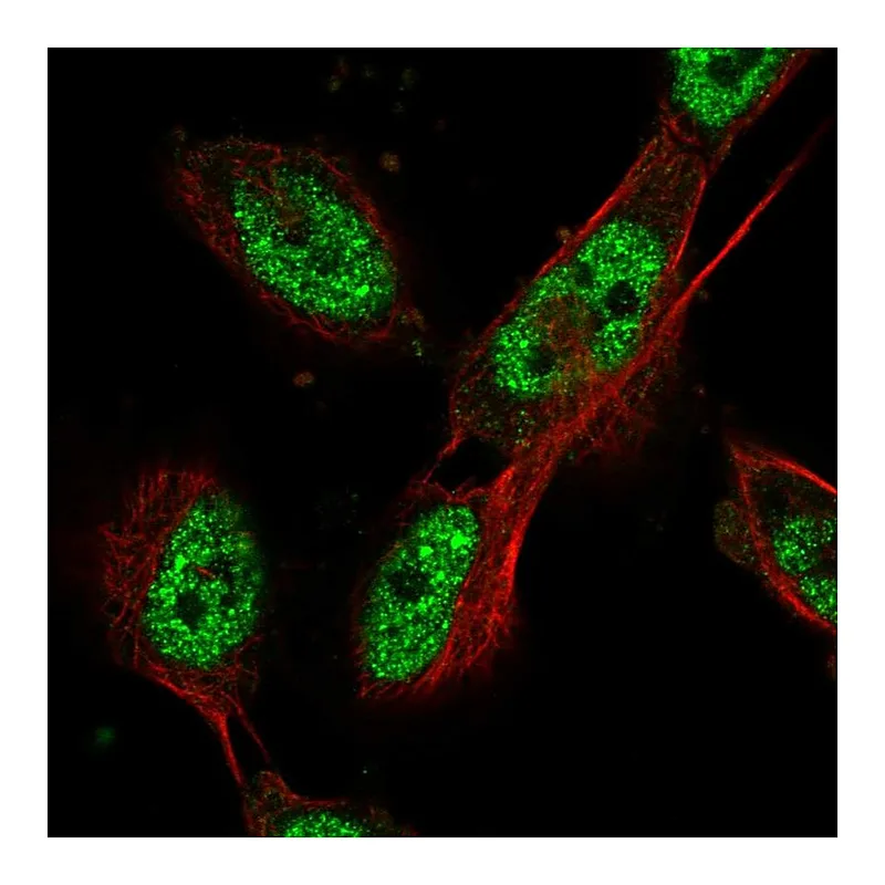 Atlas Antibodies Anti-CDC27 Antibody