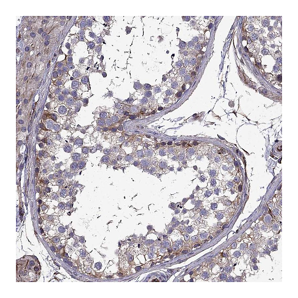 Atlas Antibodies Anti-CDC42BPA Antibody