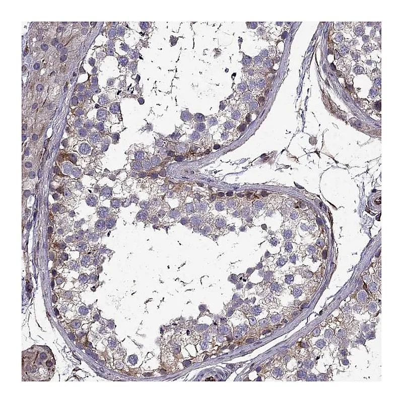 Atlas Antibodies Anti-CDC42BPA Antibody