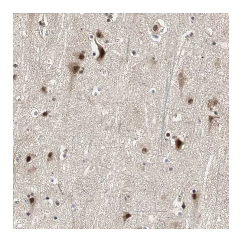 Atlas Antibodies Anti-CDC5L Antibody