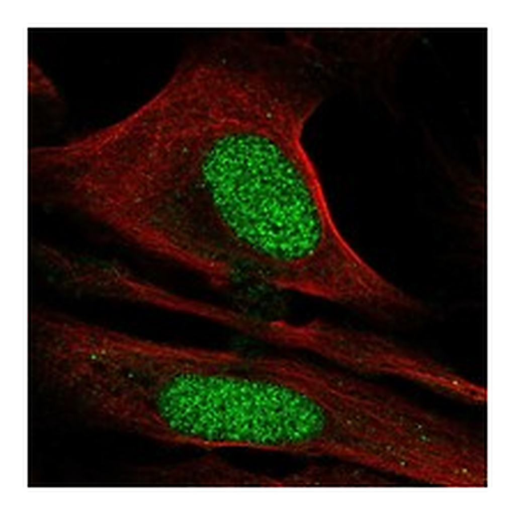 Atlas Antibodies Anti-CDC73 Antibody