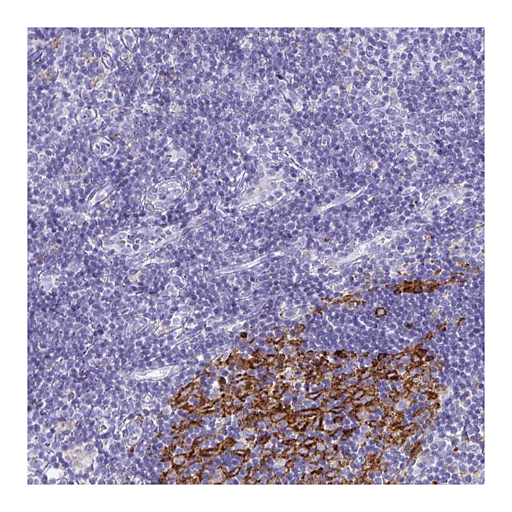 Atlas Antibodies Anti-CDCA4 Antibody