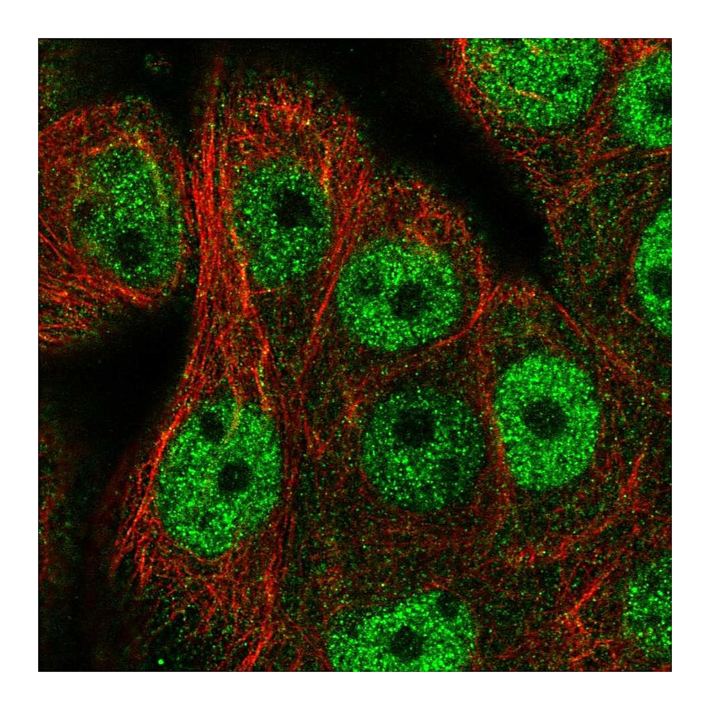 Atlas Antibodies Anti-CDCA4 Antibody