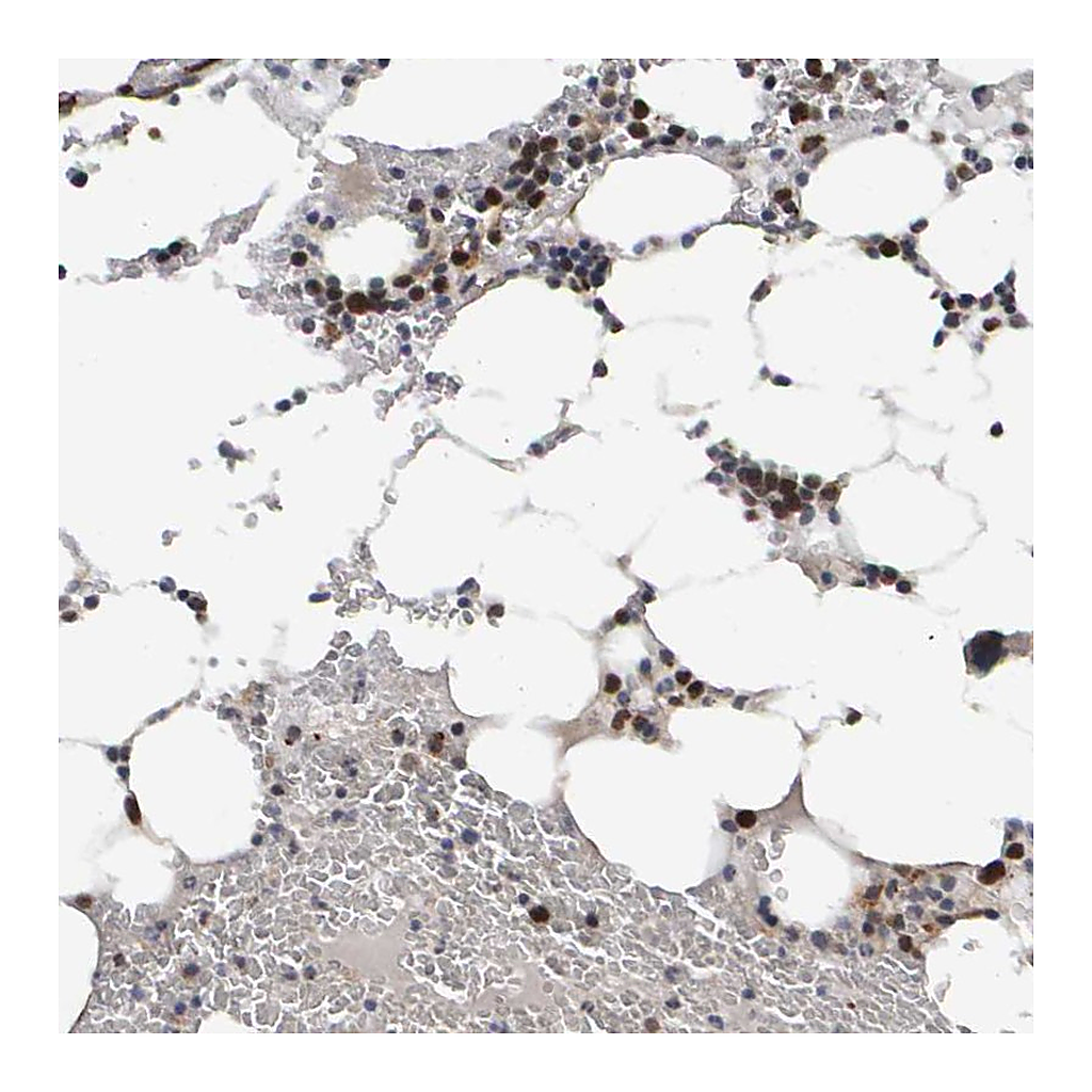 Atlas Antibodies Anti-CDCA5 Antibody