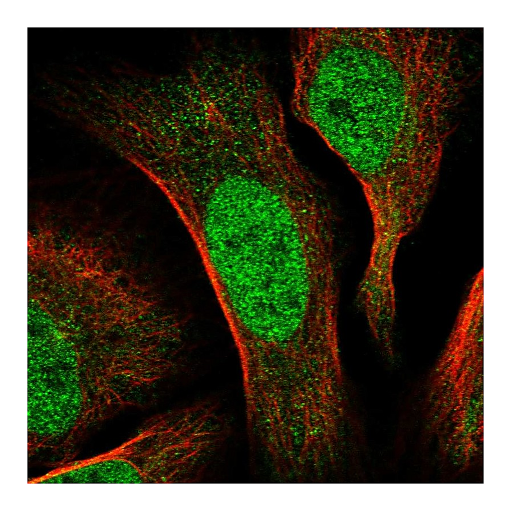 Atlas Antibodies Anti-CDCA2 Antibody