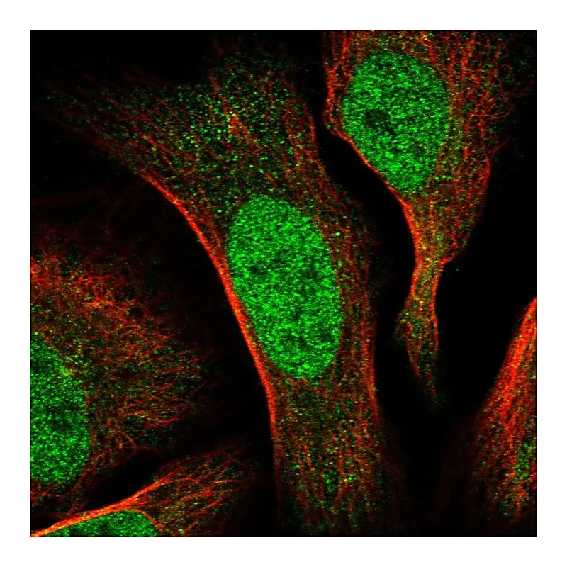Atlas Antibodies Anti-CDCA2 Antibody
