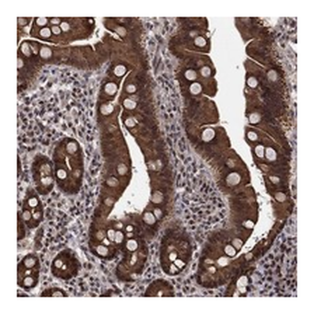 Atlas Antibodies Anti-CDCA7L Antibody