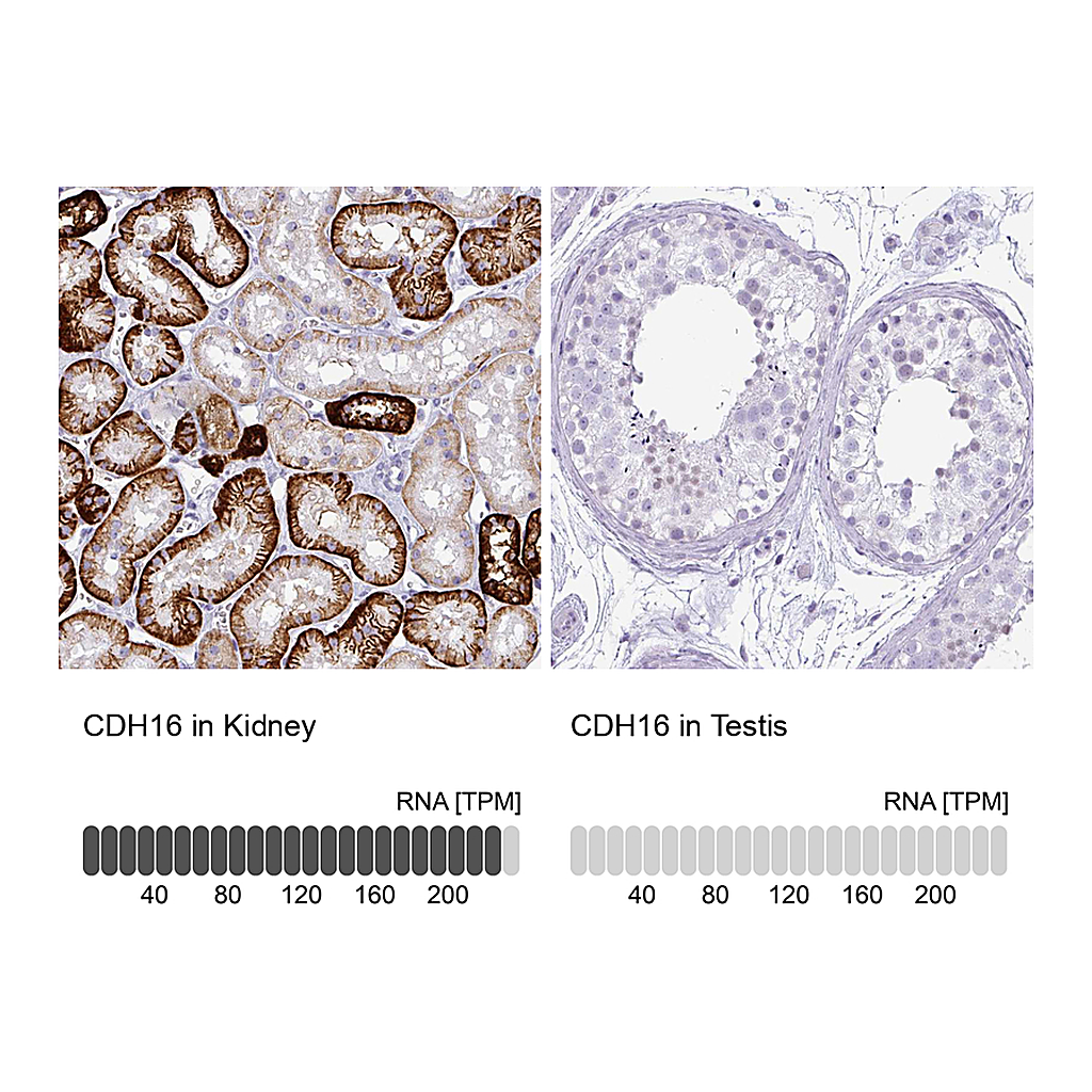 Atlas Antibodies Anti-CDH16 Antibody