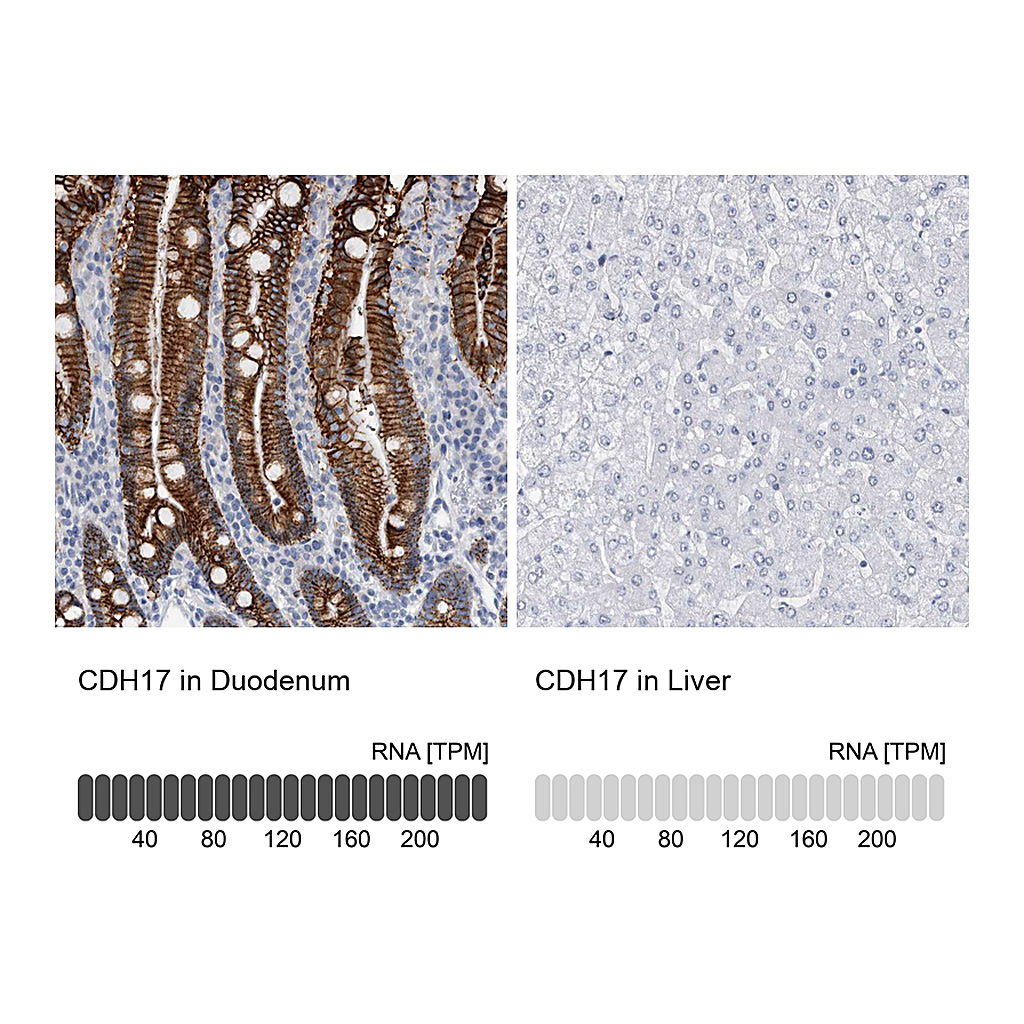 Atlas Antibodies Anti-CDH17 Antibody