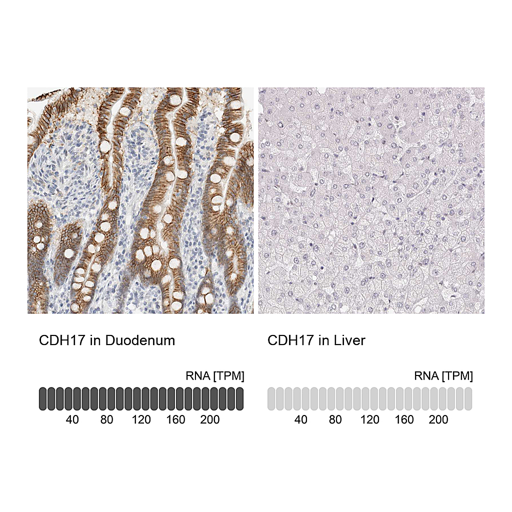 Atlas Antibodies Anti-CDH17 Antibody
