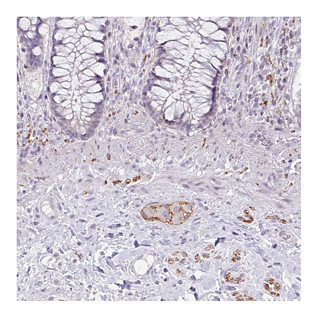 Atlas Antibodies Anti-CDH19 Antibody