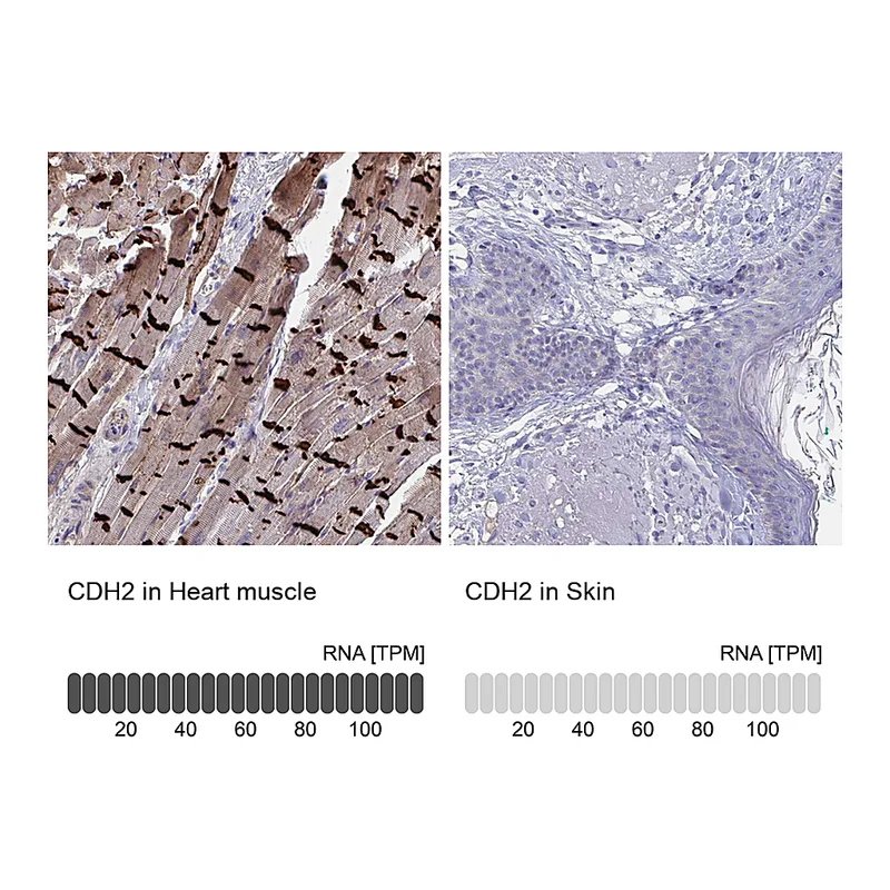 Atlas Antibodies Anti-CDH2 Antibody