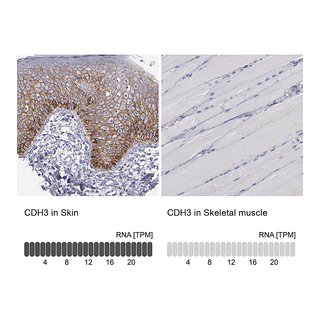 Atlas Antibodies Anti-CDH3 Antibody