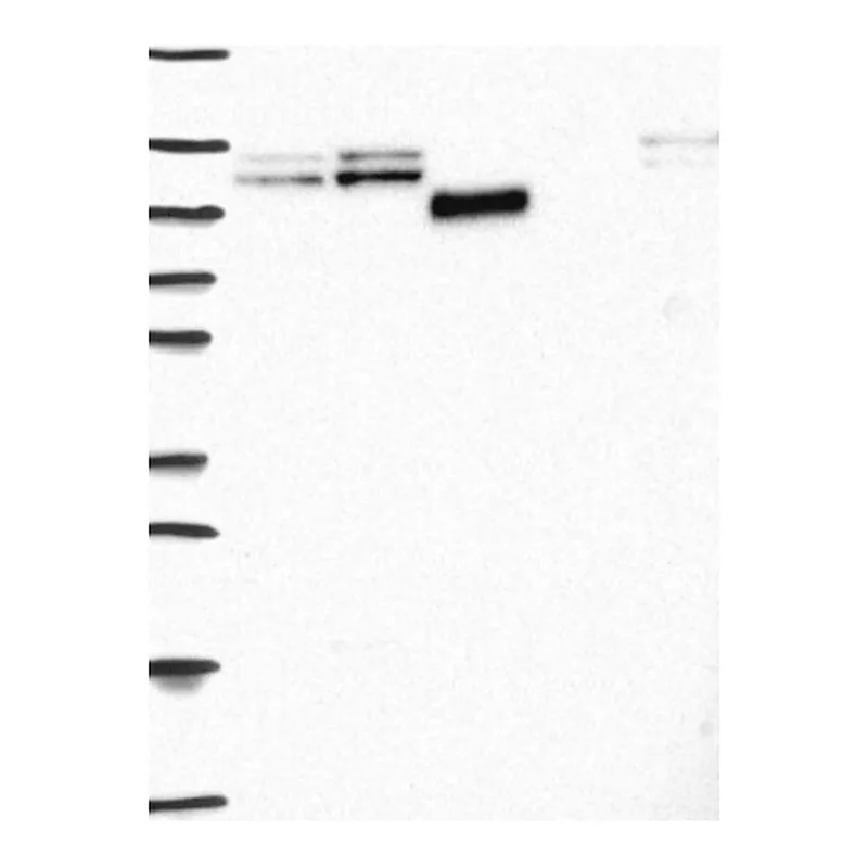 Atlas Antibodies Anti-CDH5 Antibody