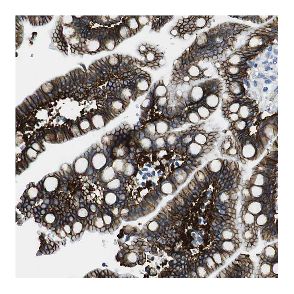 Atlas Antibodies Anti-CDH8 Antibody