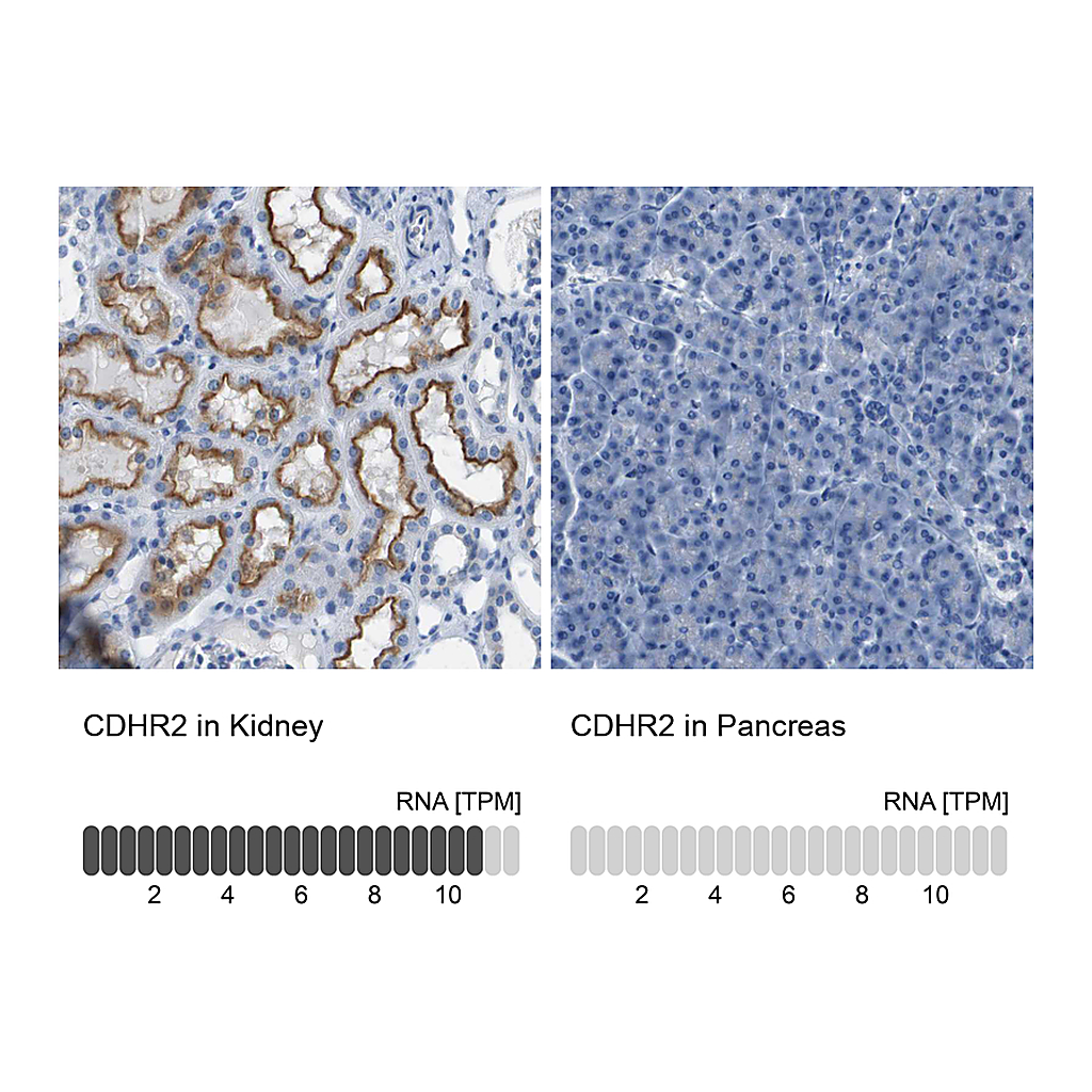 Atlas Antibodies Anti-CDHR2 Antibody