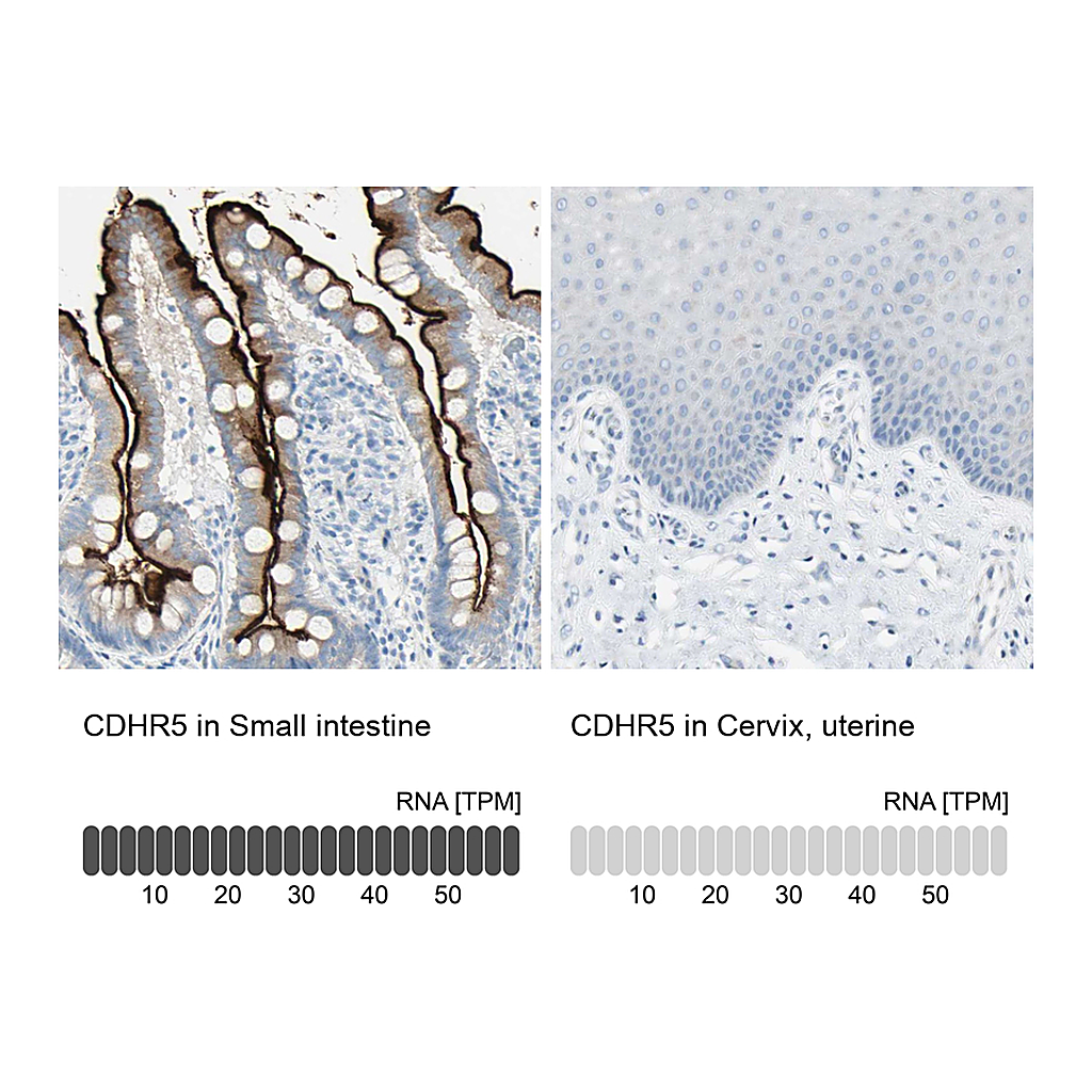 Atlas Antibodies Anti-CDHR5 Antibody