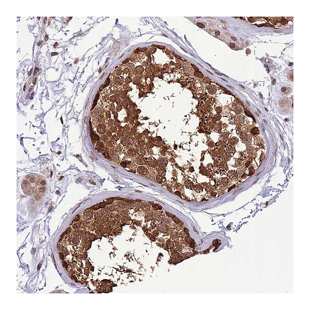 Atlas Antibodies Anti-CDIP1 Antibody