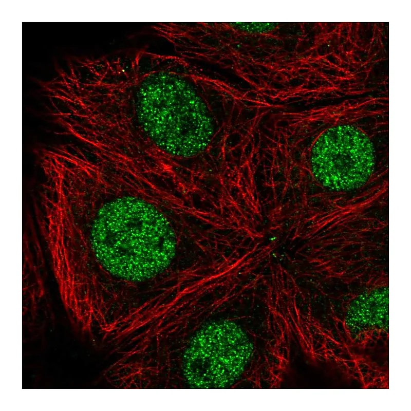 Atlas Antibodies Anti-CDK10 Antibody