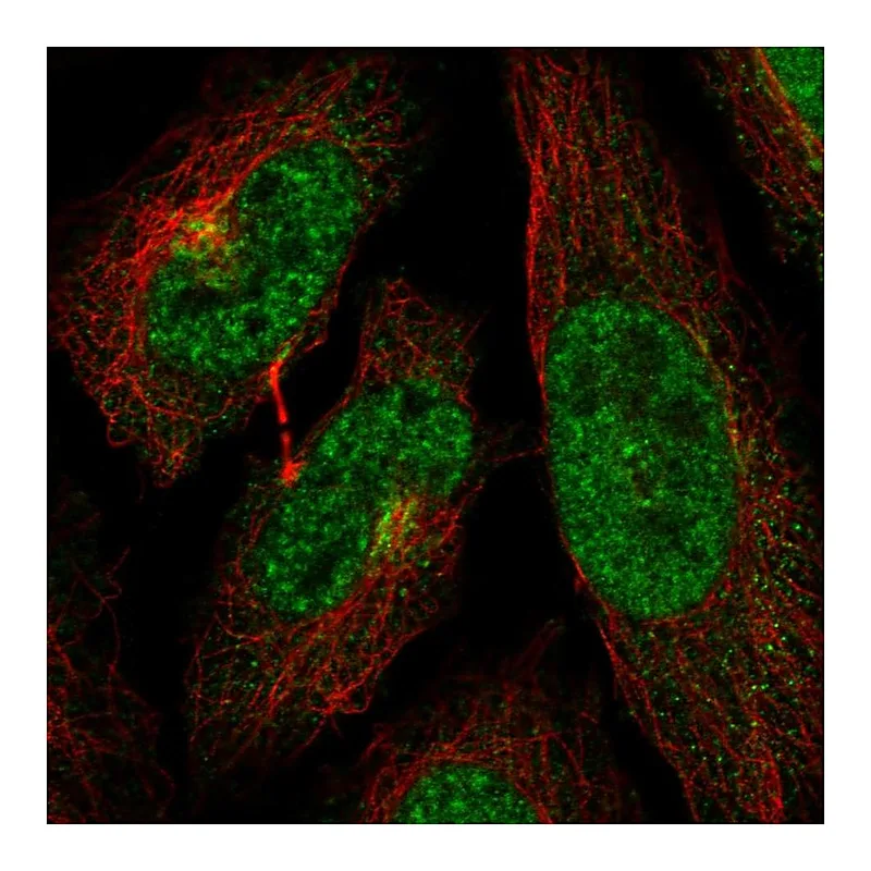 Atlas Antibodies Anti-CDK13 Antibody