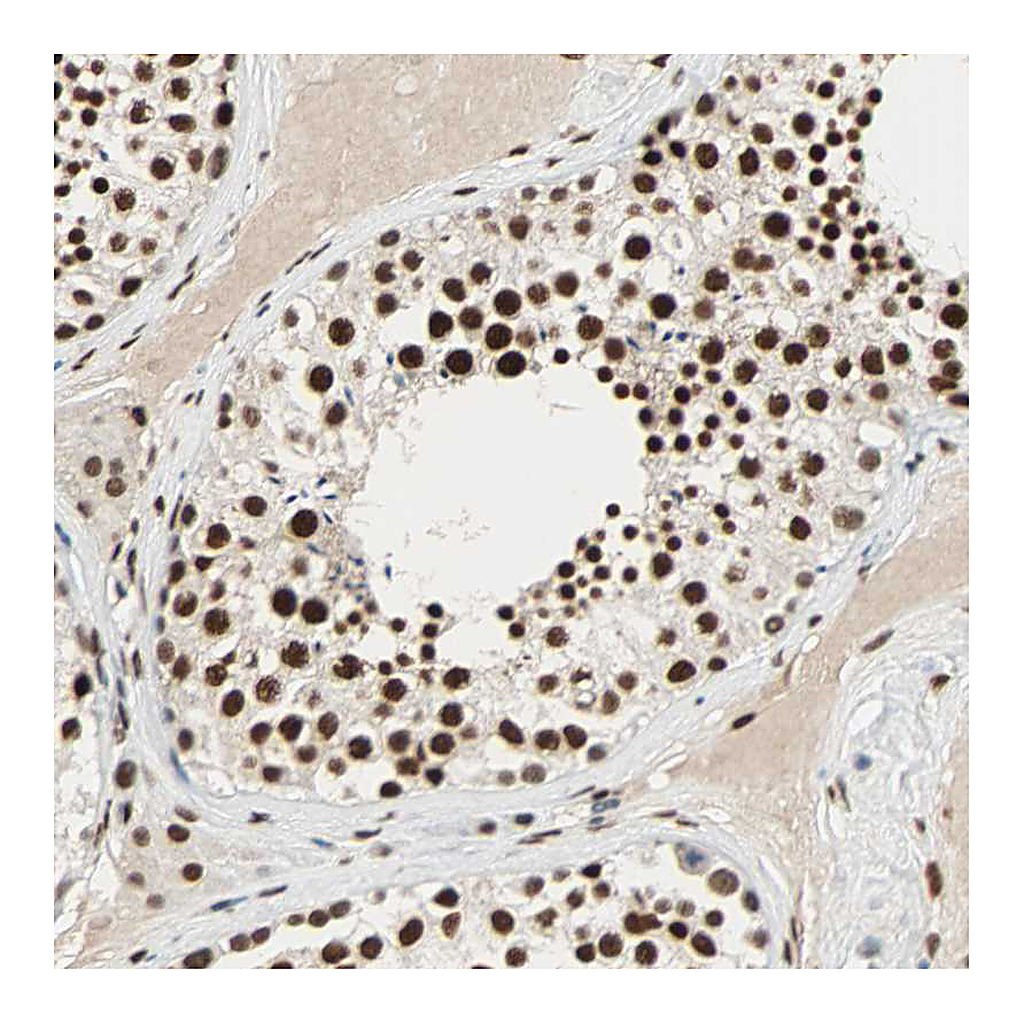 Atlas Antibodies Anti-CDK12 Antibody