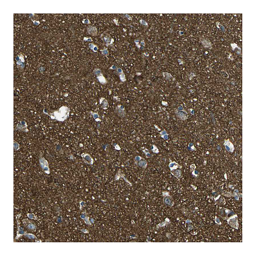Atlas Antibodies Anti-CDK17 Antibody