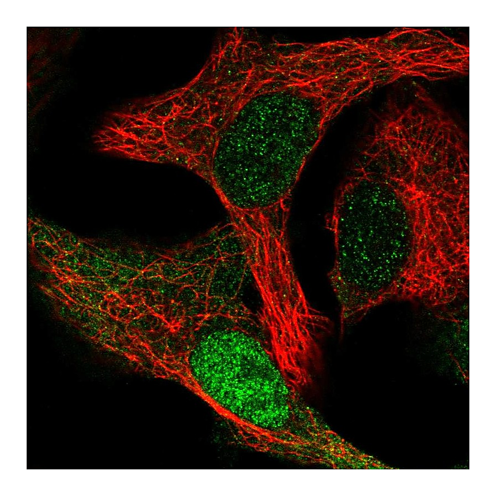 Atlas Antibodies Anti-CDK2AP1 Antibody
