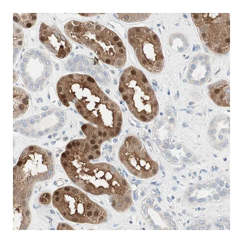 Atlas Antibodies Anti-CDK3 Antibody