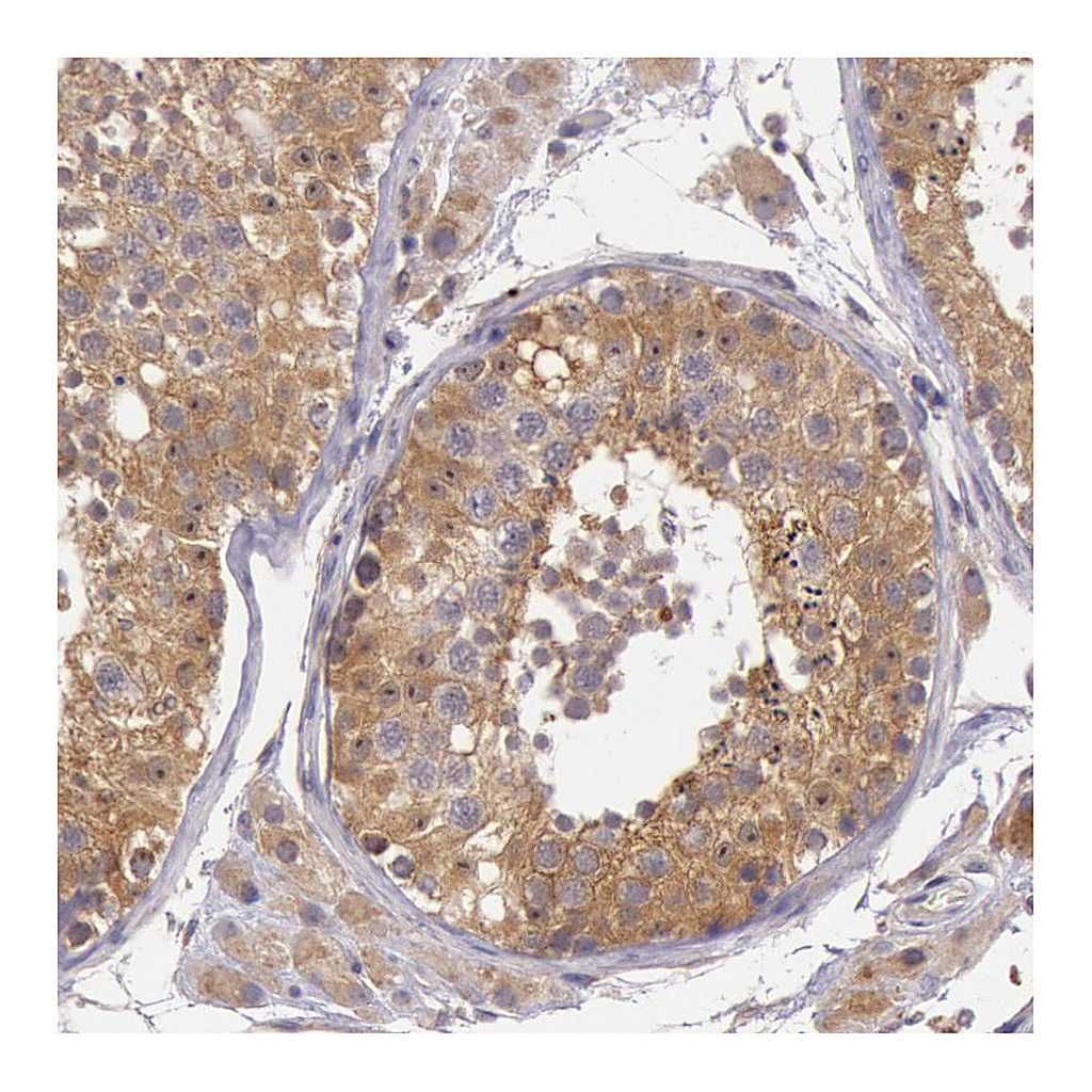 Atlas Antibodies Anti-CDK16 Antibody