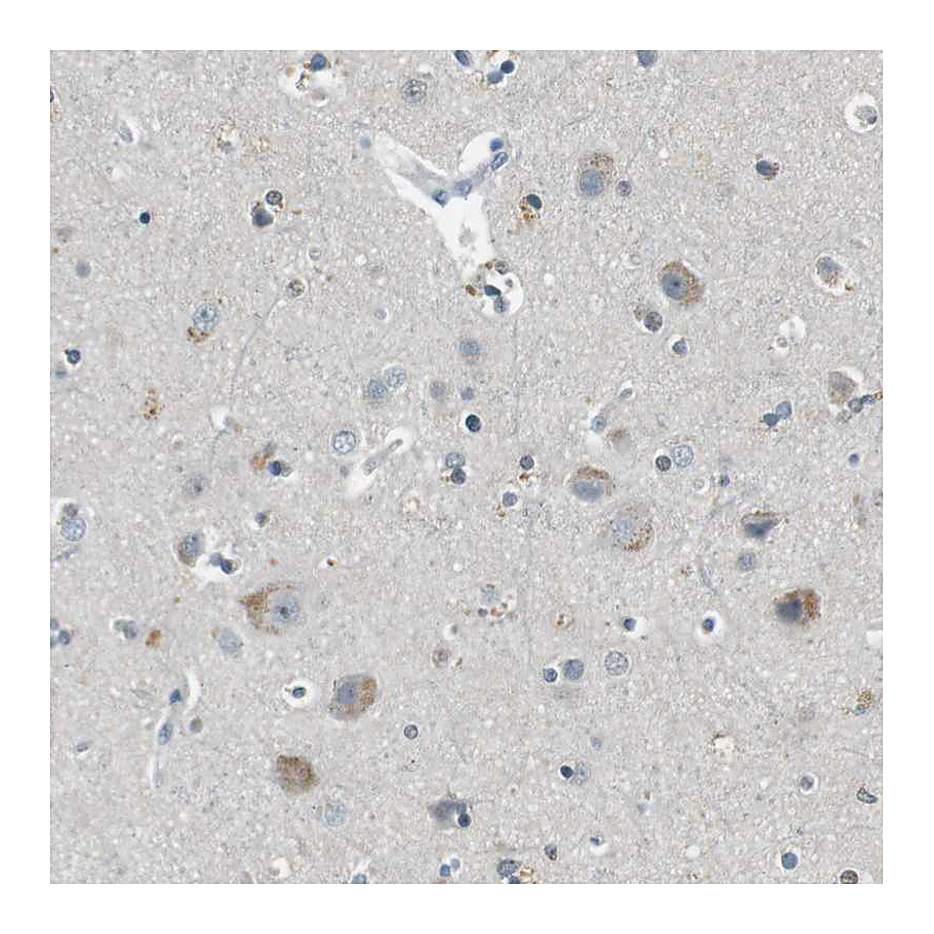 Atlas Antibodies Anti-CDK14 Antibody