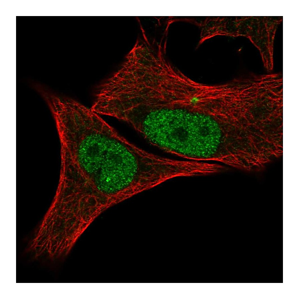 Atlas Antibodies Anti-CDK2 Antibody