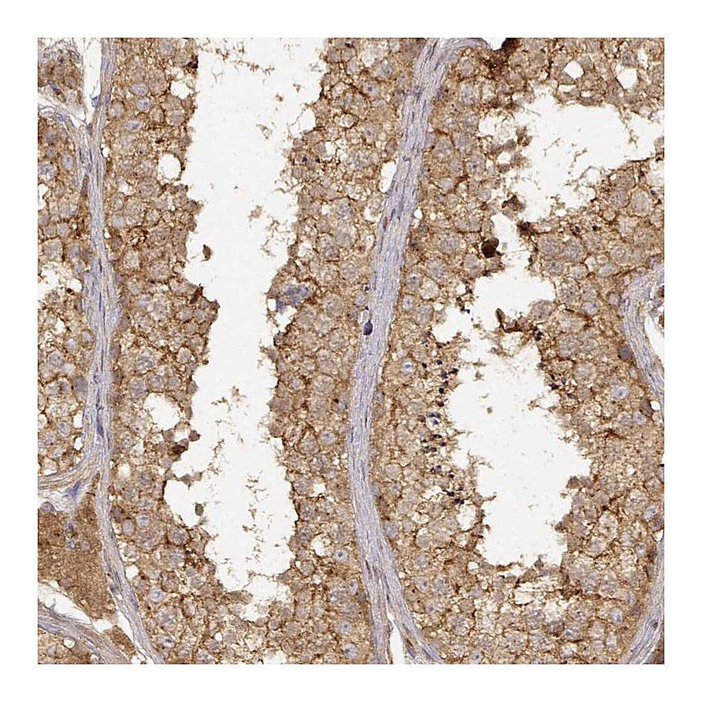 Atlas Antibodies Anti-CDK5RAP2 Antibody