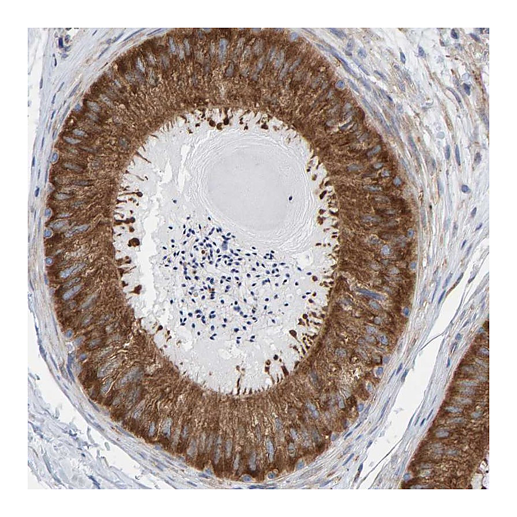 Atlas Antibodies Anti-CDK5RAP3 Antibody