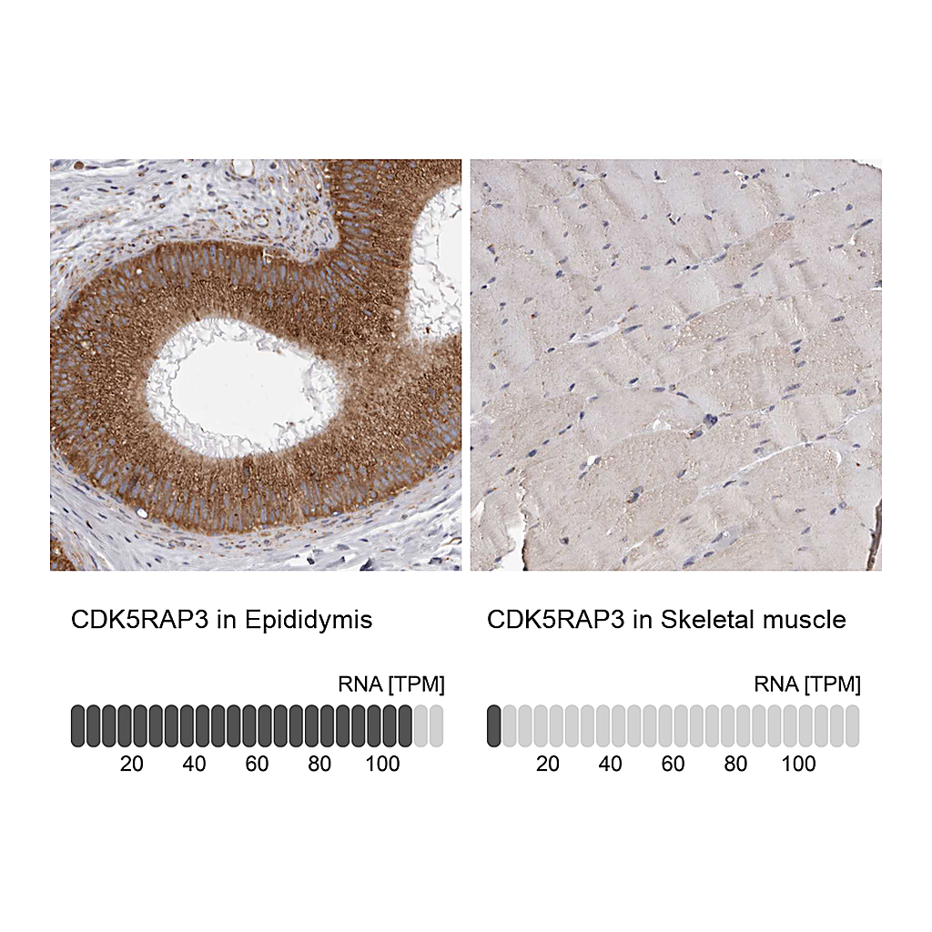 Atlas Antibodies Anti-CDK5RAP3 Antibody