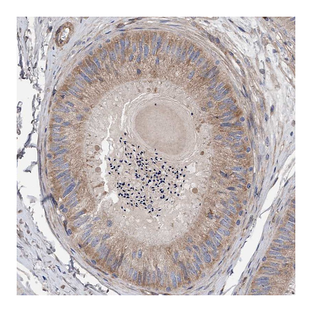Atlas Antibodies Anti-CDK5RAP3 Antibody
