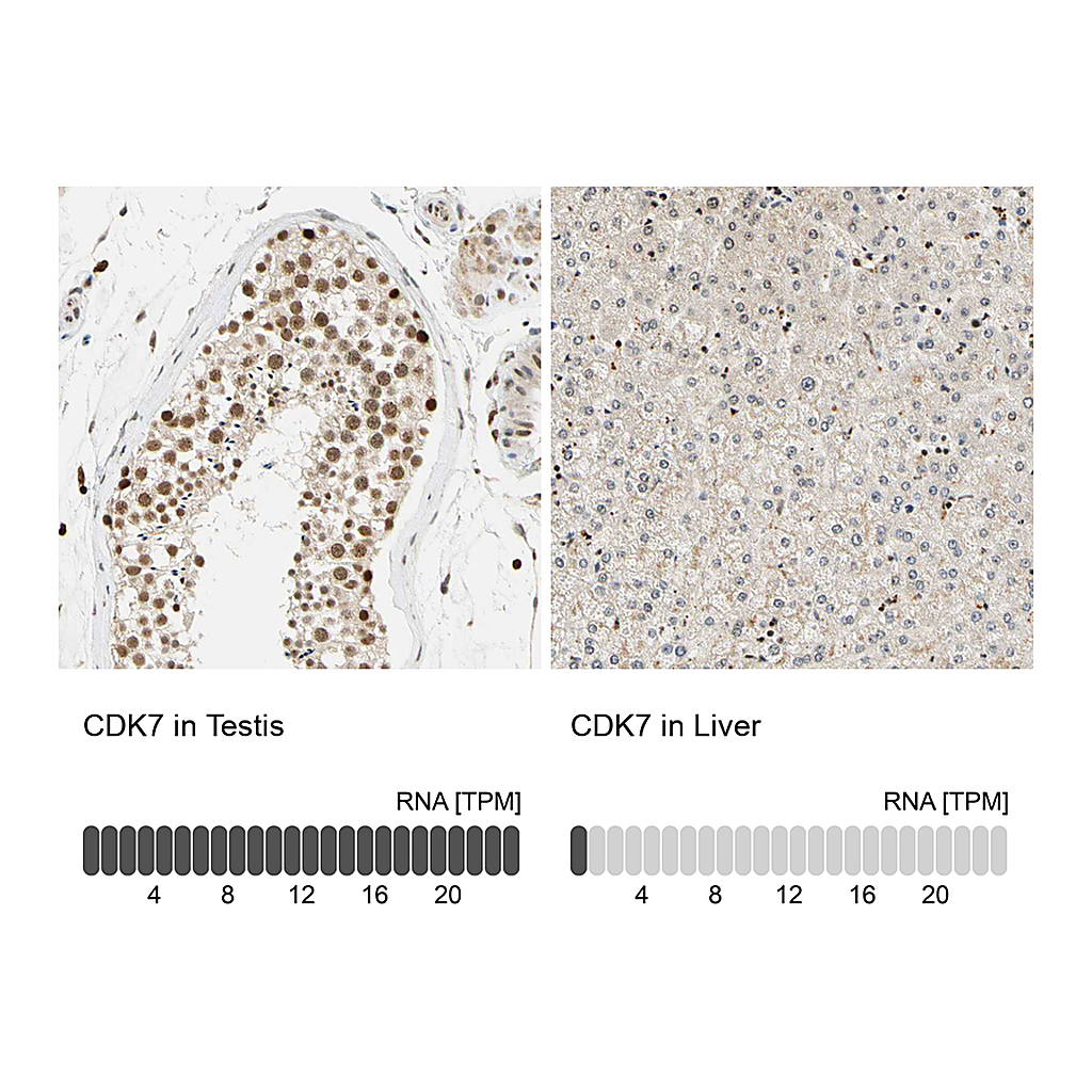 Atlas Antibodies Anti-CDK7 Antibody