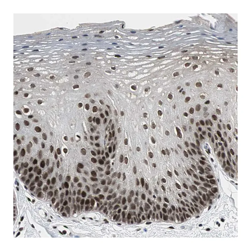 Atlas Antibodies Anti-CDK9 Antibody