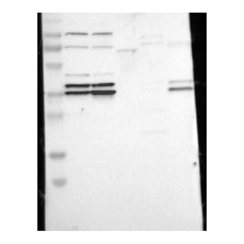 Atlas Antibodies Anti-CDK7 Antibody