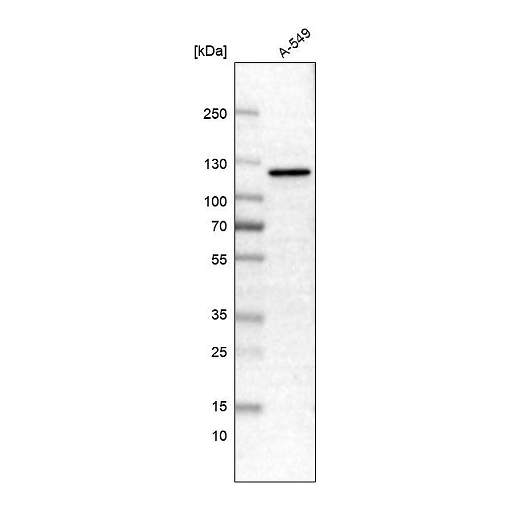 Atlas Antibodies Anti-CDKL5 Antibody