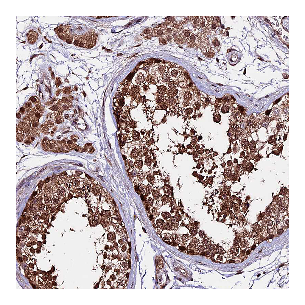 Atlas Antibodies Anti-CDKN2AIP Antibody