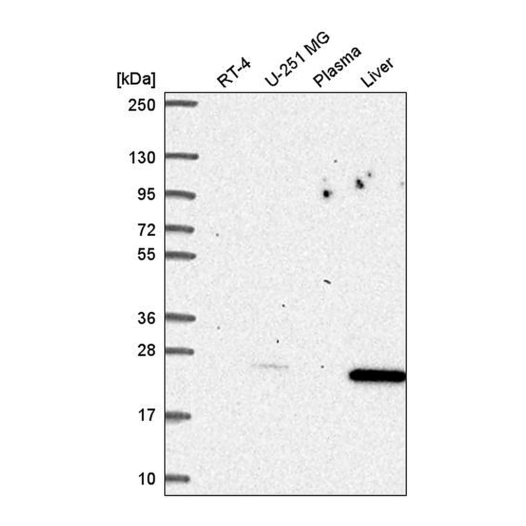 Atlas Antibodies Anti-CDKN1B Antibody