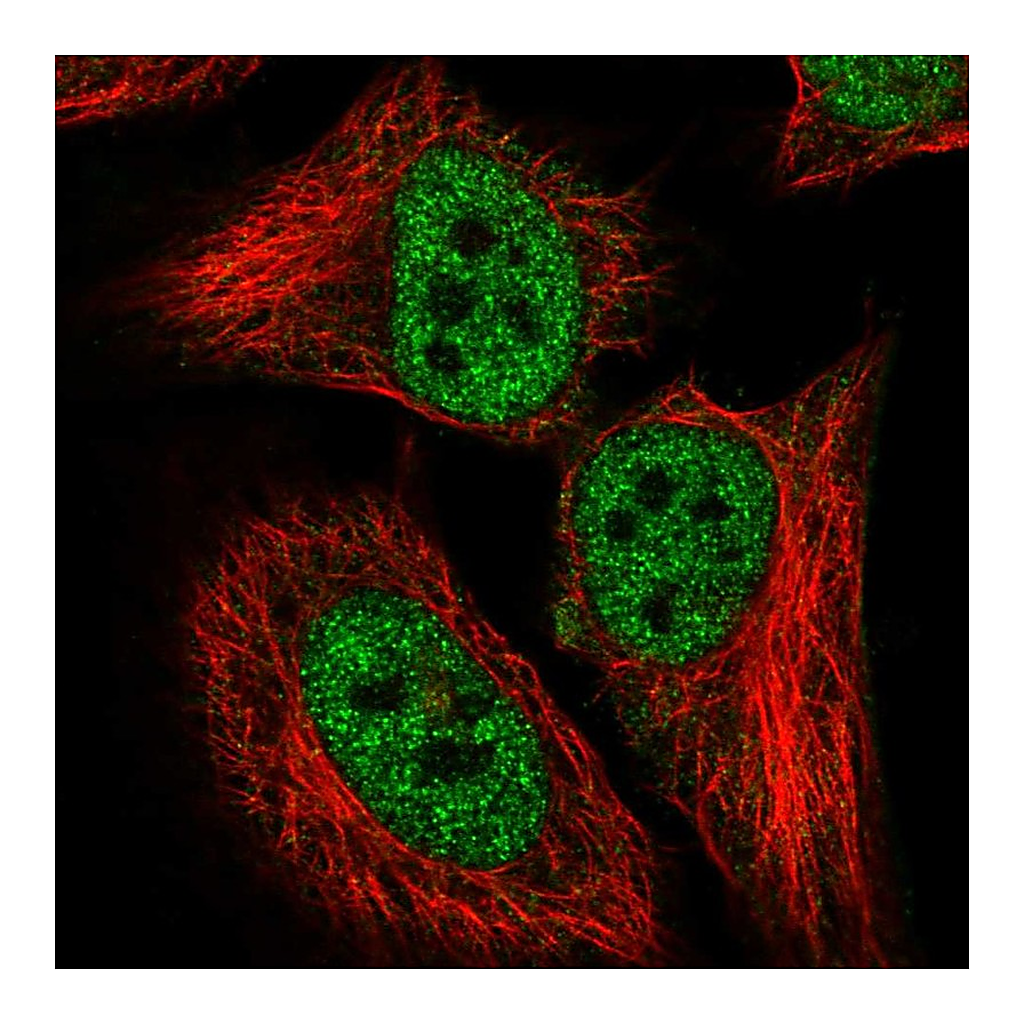 Atlas Antibodies Anti-CDKN2AIP Antibody