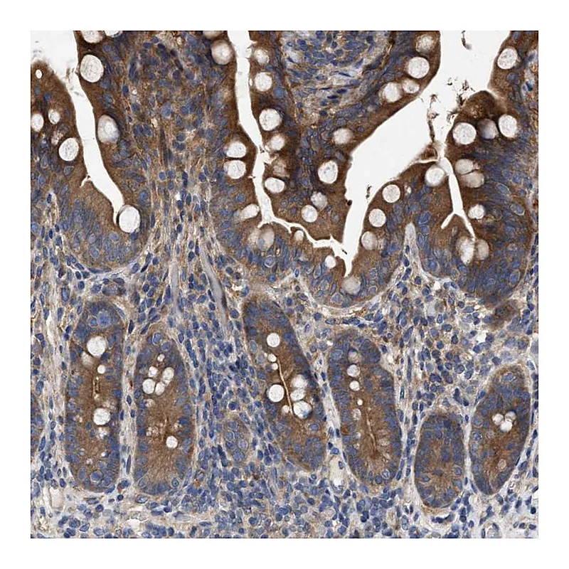 Atlas Antibodies Anti-CDKN2C Antibody