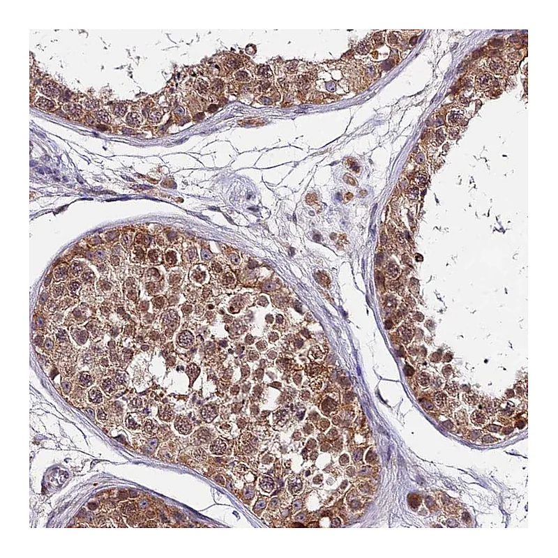 Atlas Antibodies Anti-CDNF Antibody