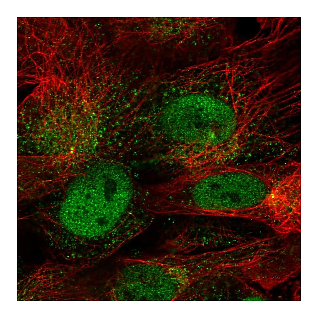 Atlas Antibodies Anti-CDR1 Antibody